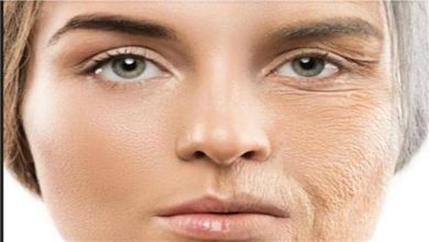صورة غير البوتوكس.. علاجات طبيعية لتجاعيد العيون