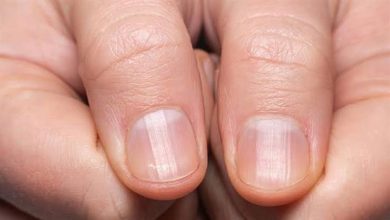 صورة تظهر على أظافرك.. 6 علامات تحذيرية تكشف الإصابة بمرض السكري