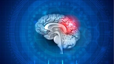 صورة 4 علامات قد تنذرك بحدوث جلطة على الدماغ.. راقب طريقة كلامك