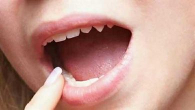 صورة أعراض إذا ظهرت على اللسان تدل على مرض خطير