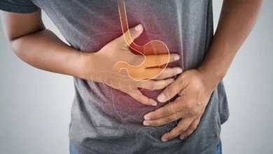 صورة نصائح مهمة لتعديل حموضة المعدة