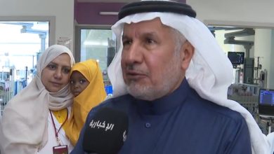 صورة وضع التوأم السيامي النيجري مستقر.. والمؤشرات الحيوية جيدة