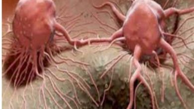 صورة اذهب للطبيب فورا.. 6 علامات خطيرة لـ السرطان