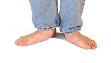 صورة ما أسباب وأعراض الأقدام المسطحة عند الأطفال؟
