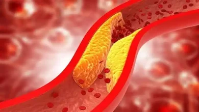صورة تمنع أمراض القلب والسكتة الدماغية.. 5 أطعمة تخفض الكوليسترول الضار