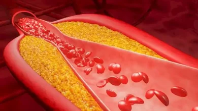 صورة يحارب الكوليسترول.. 4 مشروبات طبيعية تقوي الشرايين وتريح القلب