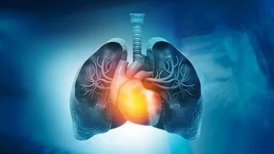 صورة 3 علامات في أطراف أصابعك تدل على مشكلة خطيرة في الرئة
