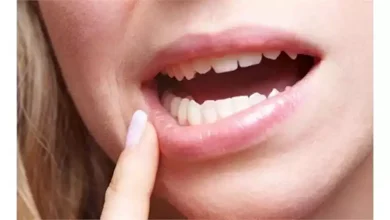 صورة عادات يومية تزيد خطر الإصابة بسرطان الفم