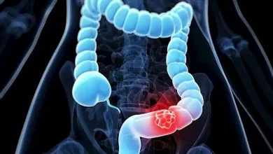 صورة رجل مصاب بسرطان القولون يكشف عن 6 أعراض خطيرة- احذرها