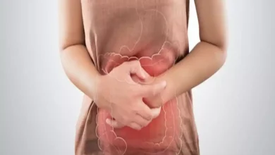 صورة أطعمة أساسية لاستعادة توازن ميكروبيوم الأمعاء ودعم الصحة الهضمية