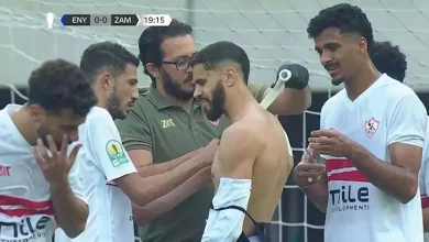 صورة أحدهما في مفصل الكتف.. الزمالك يعلن طبيعة إصابة ثنائي الفريق في مباراة إنيمبا