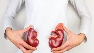 صورة أسباب وأعراض وخطورة خحصوات الكلى