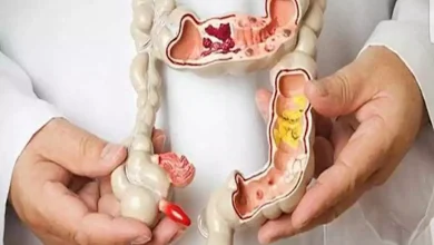 صورة طعام شهير يحمي من سرطان الأمعاء.. احرص على تناوله