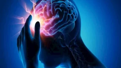 صورة احذر.. الشعور بهذا الشيء علامة على السكتة الدماغية