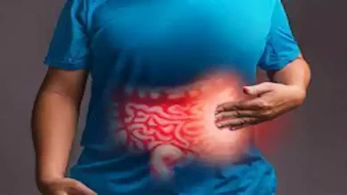 صورة 5 أطعمة قد تهيج بطانة المعدة- توقف عن تناولها