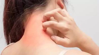 صورة دراسة حديثة تكشف مفاجأة .. تلوث الهواء يقي من سرطان الجلد