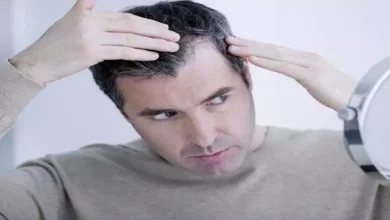 صورة ما أسباب وعلاج ظهور الشيب المبكر؟