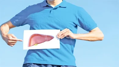 صورة تليف الكبد.. إليك الأعراض والأسباب وطرق الوقاية