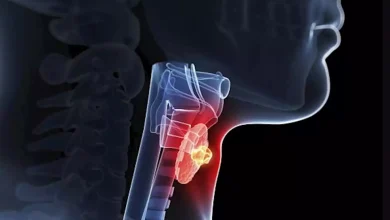 صورة 5 أعراض واضحة تدل على التهابات الغدد الجار درقية