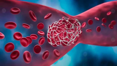 صورة 5 أطعمة تحمي القلب والأوعية الدموية وتقي من الجلطات