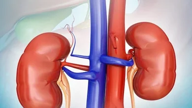 صورة دون أعراض.. احذر هذا الأمر في جسمك يسبب تلف الكلى