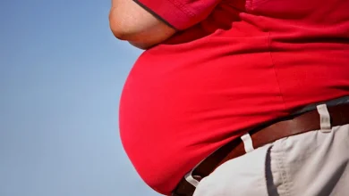 صورة ما تأثير السمنة المفرطة على صحة الجسم؟