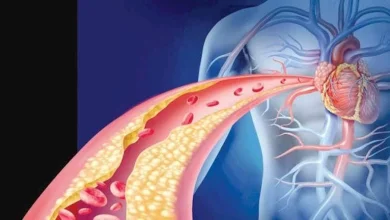 صورة كيف تؤثر مستويات الكوليسترول على الدماغ؟