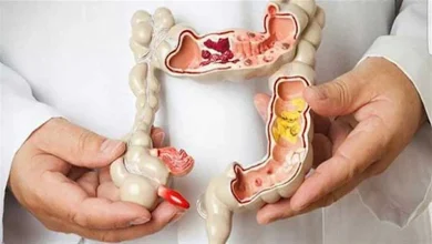 صورة أطعمة تسبب تهيج القولون وتقرحات المعدة.. تجنّبها ليلًا