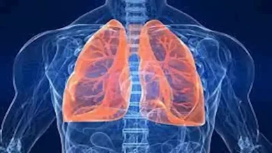 صورة سبب وفاة البابا فرنسيس.. احذر هذه الأعراض والعلامات