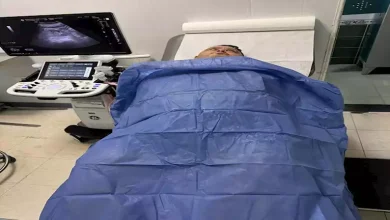 صورة المرض الذي تسبب في تدهور حالة أمح الدولي ووفاته
