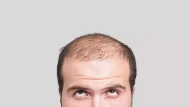 صورة تجنبوا الصلع.. أشياء بسيطة قد تنقل العدوى دون أن تدركوا