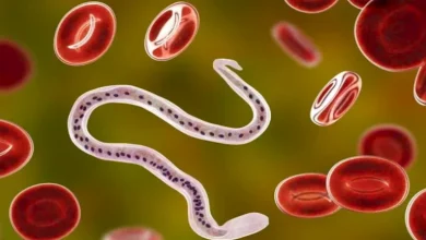 صورة 10 علامات تدل على الإصابة بالديدان الطفيلية