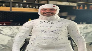 صورة محمد أنور ينشر صورة له بـ “جبيرة جبس”.. وزينة تعلق: “واضح أنك زي الفل”