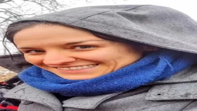 صورة صور صادمة.. امرأة تدعي تغير لون بشرتها بسبب طعام شهير