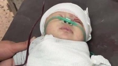 صورة شام محارب.. رضيعة فقدت ذراعها تحت القصف واستشهدت متأثرة بجراحها
