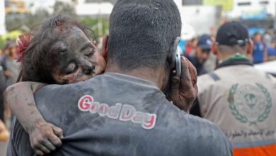 صورة تقرير: 391 امرأة بترت أطرافهن خلال الحرب يواجهن مصيرا قاسيا خلال النزوح
