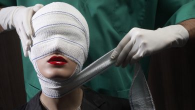 صورة فنانة مصرية شهيرة تثير الجدل بعد إجراء عملية تجميل لوجهها (فيديو)