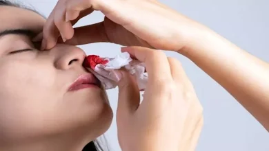 صورة نزيف الأنف علامة تكشف ارتفاع ضغط الدم المرتفع.. لا تتجاهلها