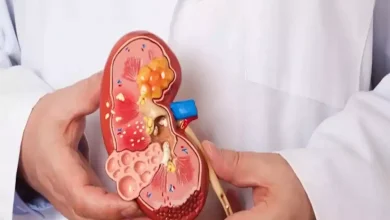 صورة من أخطر 10 أمراض عالمياً… مرض قاتل يشهد زيادة مقلقة في الإصابات
