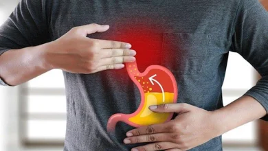 صورة كيف يؤثر ارتجاع المريء على صحة القلب؟