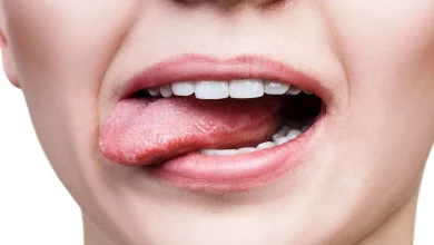 صورة علامة تظهر بالفم تنذرك بسرطان قاتل.. احذرها