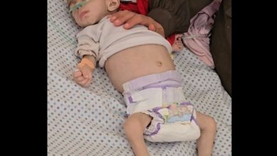 صورة استشهاد طفلة في غزة بسبب المجاعة ما يرفع الحصيلة إلى 54