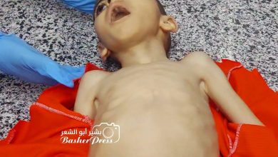 صورة استشهاد طفل بغزة بسبب الجوع (صور وفيديو)