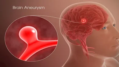 صورة احذر.. أعراض محتملة لـ تمدد الأوعية الدموية