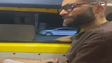صورة بعد مأساة محمد شوقي.. ما هو التهاب الغدد العرقية القيحي؟