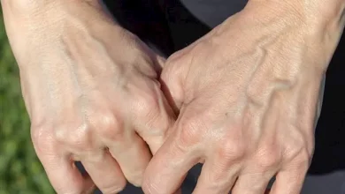 صورة ظهور عروق اليد البارزة.. 5 حالات تستدعي الذهاب للطبيب