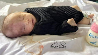 صورة 18 وفاة خلال 24 ساعة بسبب الجوع في غزة
