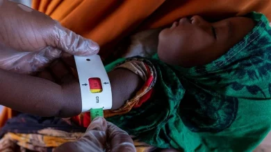 صورة وفاة 13 طفلًا بسبب سوء التغذية في مخيم بدارفور