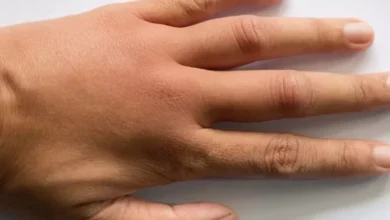 صورة تظهر على أصابعك- 3 علامات تخبرك بأن كبدك مريض.. أعراض أمراض الكبد على