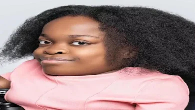 صورة “الطول مجرد رقم”.. 10 صور لأقصر عارضة أزياء في العالم تدخل جينيس